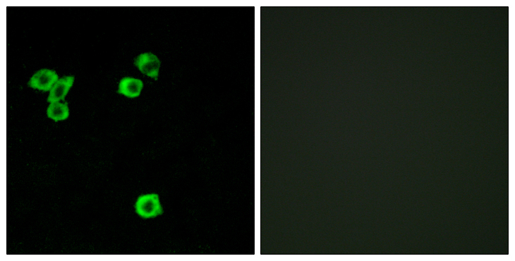 RPS6KC1 Antibody - Immunofluorescence analysis of LOVO cells, using RPS6KC1 Antibody. The picture on the right is blocked with the synthesized peptide.