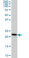 RPS7 / Ribosomal Protein S7 Antibody - RPS7 monoclonal antibody clone 3G4 Western blot of RPS7 expression in HeLa.