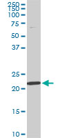 RPS7 / Ribosomal Protein S7 Antibody - RPS7 monoclonal antibody clone 3G4. Western blot of RPS7 expression in NIH/3T3.