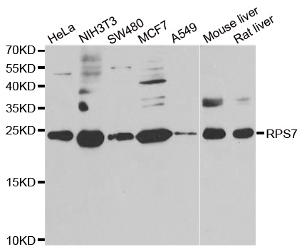 RPS7 / Ribosomal Protein S7 Antibody - Western blot analysis of extracts of various cell lines, using RPS7 antibody.