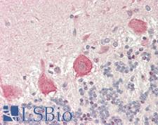 RPS7 / Ribosomal Protein S7 Antibody - Human Brain, Cerebellum: Formalin-Fixed, Paraffin-Embedded (FFPE)