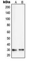 RPS8 / Ribosomal Protein S8 Antibody - Western blot analysis of RPS8 expression in HepG2 (A); A431 (B) whole cell lysates.