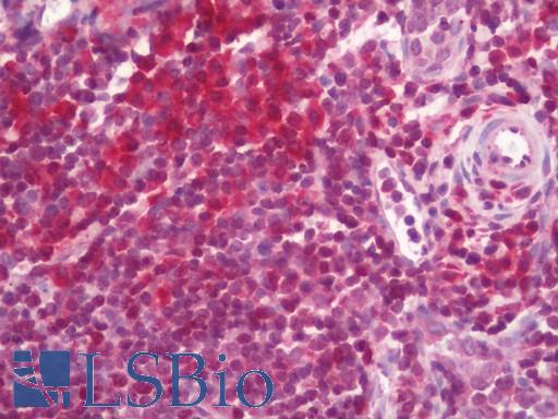 RPSA / Laminin Receptor Antibody - Human Tonsil: Formalin-Fixed, Paraffin-Embedded (FFPE)