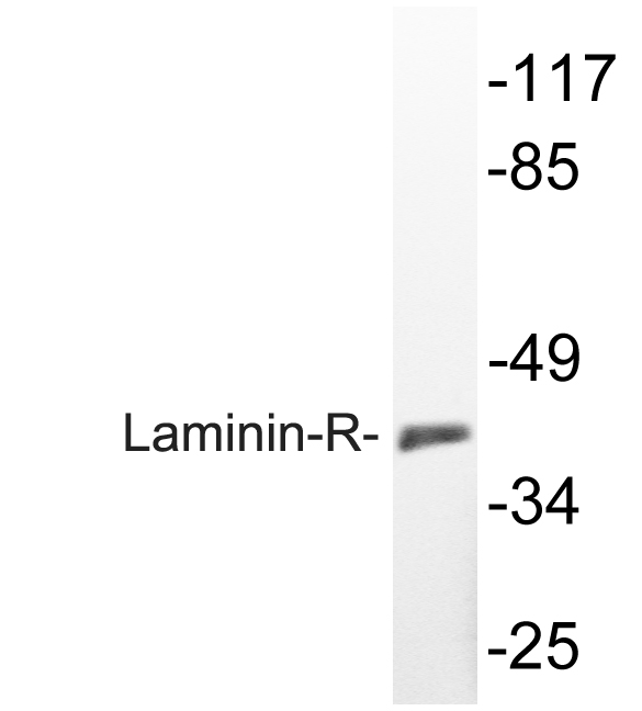 RPSA / Laminin Receptor Antibody - Western blot analysis of lysate from K562 cells, using Laminin-R antibody.