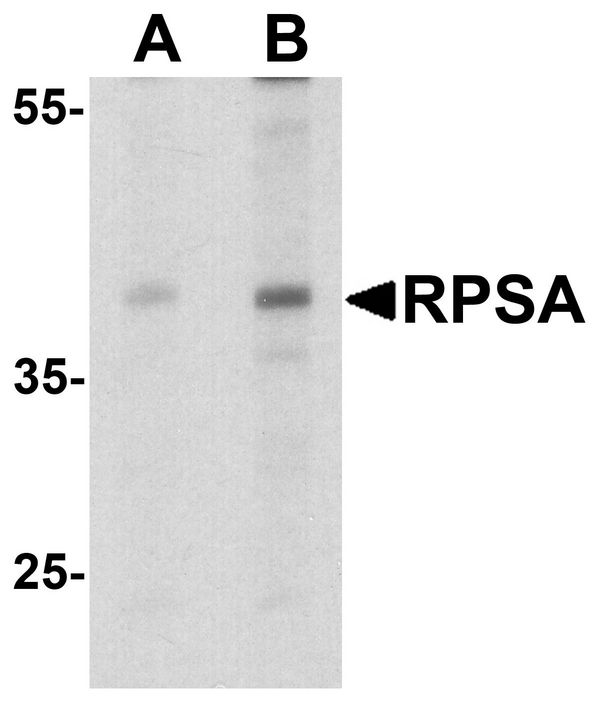 RPSA / Laminin Receptor Antibody - Western blot analysis of RPSA in HepG2 cell lysate with RPSA antibody at (A) 1 and (B) 2 ug/ml.