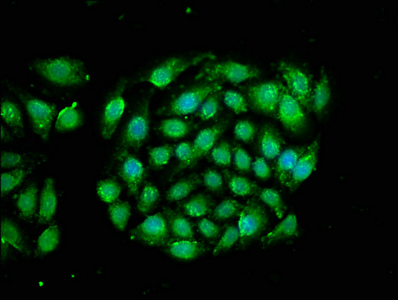 RRAGA Antibody - Immunofluorescence staining of A549 cells with RRAGA Antibody at 1:66, counter-stained with DAPI. The cells were fixed in 4% formaldehyde, permeabilized using 0.2% Triton X-100 and blocked in 10% normal Goat Serum. The cells were then incubated with the antibody overnight at 4°C. The secondary antibody was Alexa Fluor 488-congugated AffiniPure Goat Anti-Rabbit IgG(H+L).