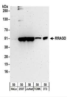 RRAGD Antibody - Detection of Human and Mouse RRAGD by Western Blot. Samples: Whole cell lysate (50 ug) from HeLa, 293T, Jurkat, mouse TCMK-1, and mouse NIH3T3 cells. Antibodies: Affinity purified rabbit anti-RRAGD antibody used for WB at 0.1 ug/ml. Detection: Chemiluminescence with an exposure time of 3 minutes.