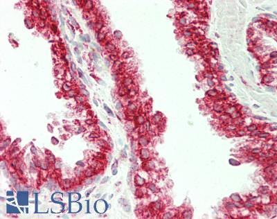 RRBP1 / hES Antibody - Human Prostate: Formalin-Fixed, Paraffin-Embedded (FFPE)