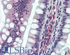 RREB1 Antibody - Human Small Intestine: Formalin-Fixed, Paraffin-Embedded (FFPE)