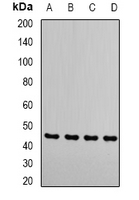 RRM2 Antibody - Western blot analysis of RRM2 expression in MCF7 (A); HeLa (B); Jurkat (C); mouse thymus (D) whole cell lysates.