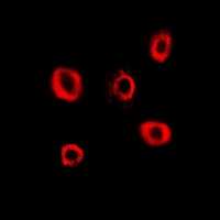 RRM2 Antibody - Immunofluorescent analysis of RRM2 staining in HeLa cells. Formalin-fixed cells were permeabilized with 0.1% Triton X-100 in TBS for 5-10 minutes and blocked with 3% BSA-PBS for 30 minutes at room temperature. Cells were probed with the primary antibody in 3% BSA-PBS and incubated overnight at 4 deg C in a humidified chamber. Cells were washed with PBST and incubated with a DyLight 594-conjugated secondary antibody (red) in PBS at room temperature in the dark.