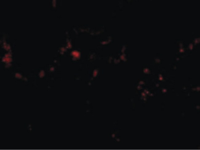 RRM2B / P53R2 Antibody - Immunofluorescence of p53R2 in Human Lung cells with p53R2 antibody at 20 ug/ml.