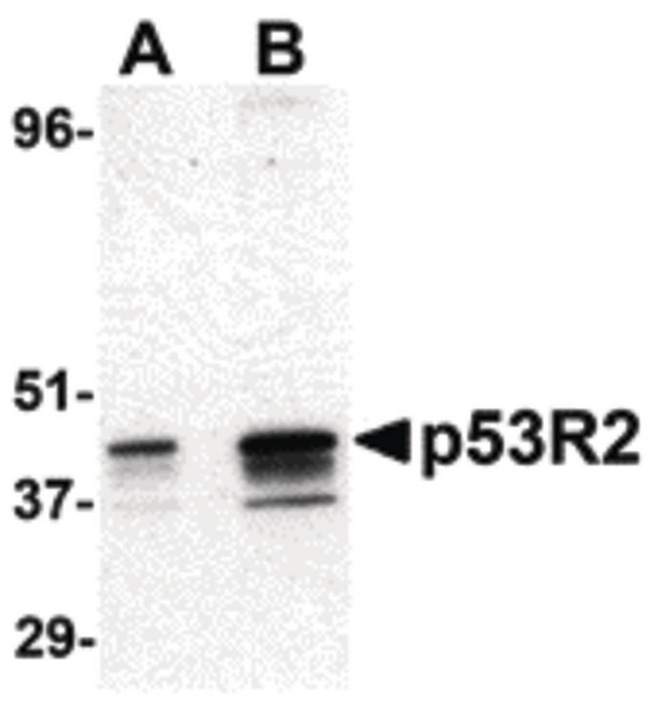 RRM2B / P53R2 Antibody - Western blot of p53R2 expression in A431 cell lysate at (A) 0.5 and (B) 1 ug /ml.