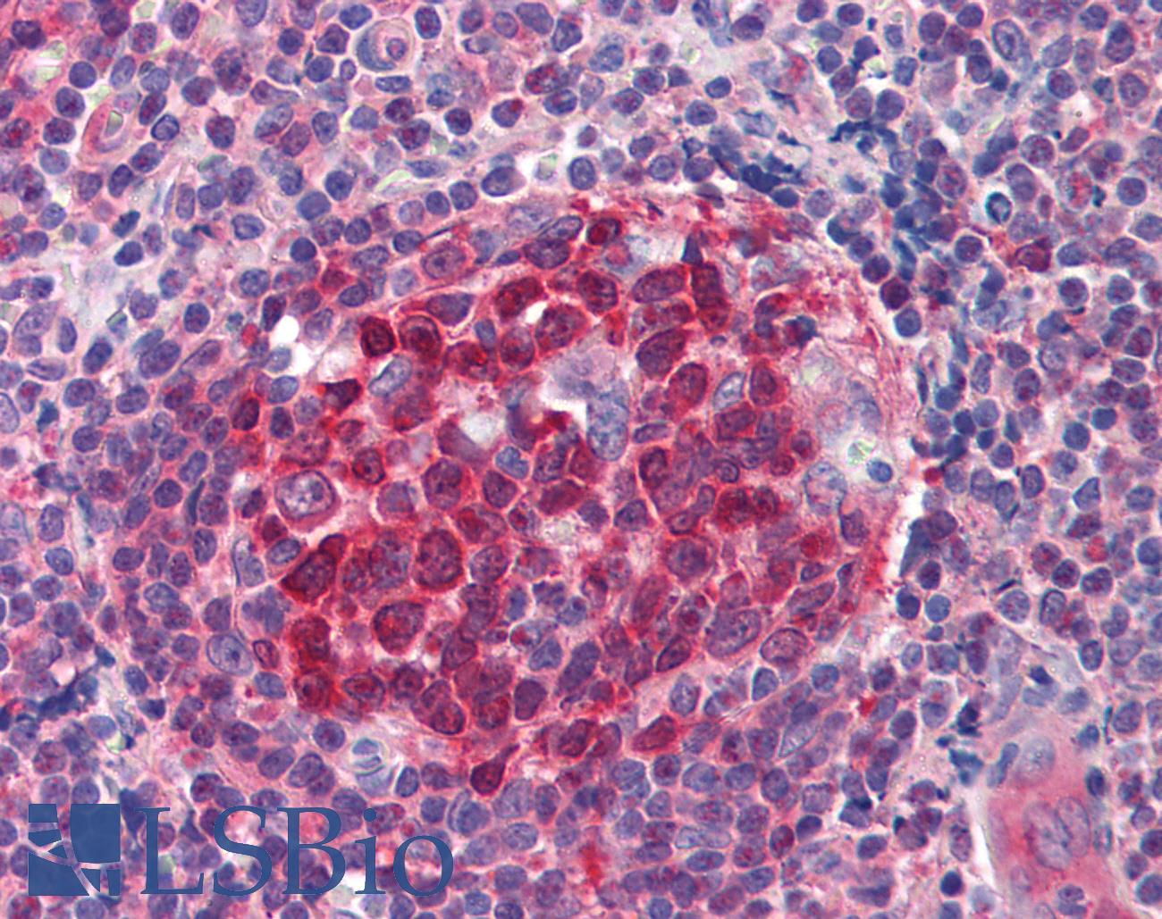 RRM2B / P53R2 Antibody - Anti-RRM2B / p53R2 antibody IHC of human tonsil. Immunohistochemistry of formalin-fixed, paraffin-embedded tissue after heat-induced antigen retrieval. Antibody concentration 5 ug/ml.