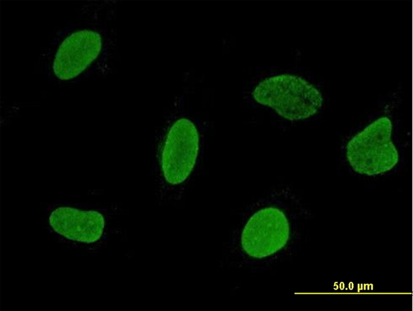RSL24D1 Antibody - Immunofluorescence of monoclonal antibody to C15orf15 on HeLa cell. [antibody concentration 10 ug/ml].