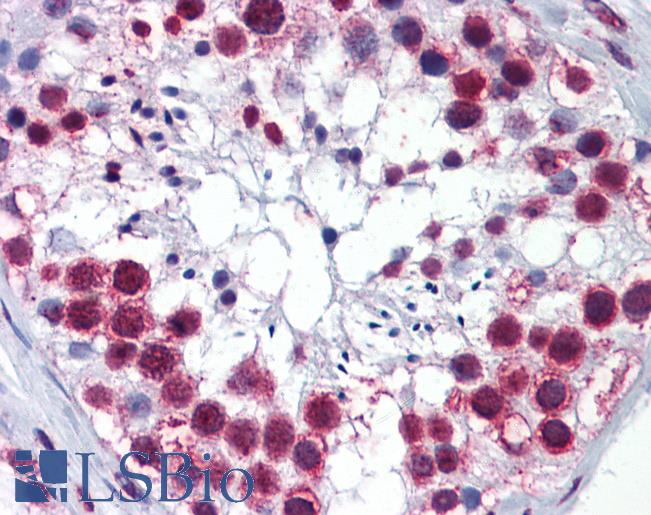 RSL24D1 Antibody - Anti-RSL24D1 / C15orf15 antibody IHC of human testis. Immunohistochemistry of formalin-fixed, paraffin-embedded tissue after heat-induced antigen retrieval. Antibody concentration 1 ug/ml.