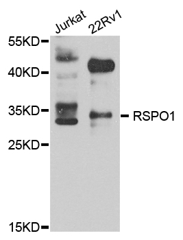 RSPO1 / RSPO Antibody - Western blot blot of extract of various cells, using RSPO1 antibody.