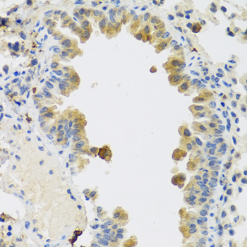 RSPO1 / RSPO Antibody - Immunohistochemistry of paraffin-embedded mouse lung using RSPO1 antibody at dilution of 1:100 (40x lens).