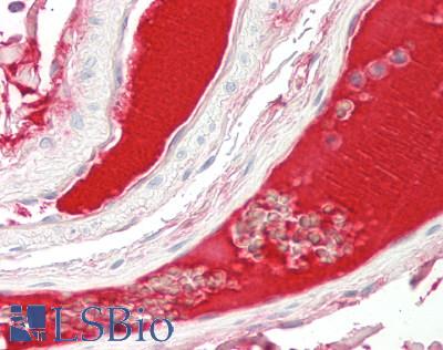 RSPO3 Antibody - Human Colon, Vessels: Formalin-Fixed, Paraffin-Embedded (FFPE)
