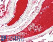 RSPO3 Antibody - Human Colon, Vessels: Formalin-Fixed, Paraffin-Embedded (FFPE)