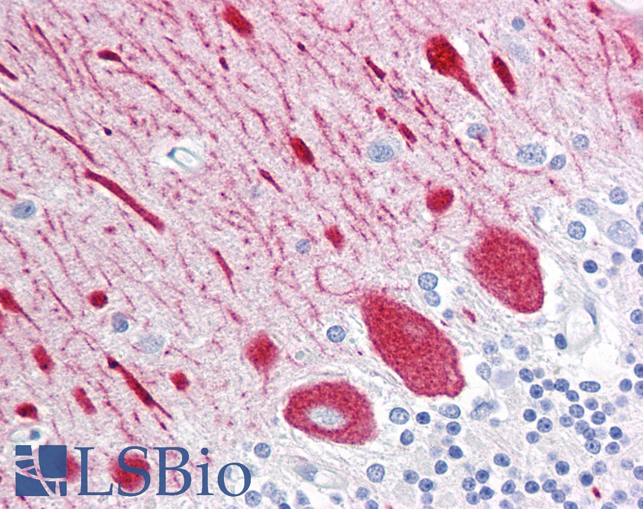 RTN1 / Reticulon 1 Antibody - Anti-Reticulon 1 antibody IHC of human brain, cerebellum. Immunohistochemistry of formalin-fixed, paraffin-embedded tissue after heat-induced antigen retrieval. Antibody concentration 10 ug/ml.