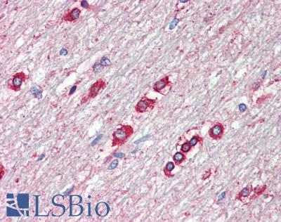 RTN3 / Reticulon 3 Antibody - Human Brain, Cerebellum, White Matter: Formalin-Fixed, Paraffin-Embedded (FFPE), at a dilution of 1:50.