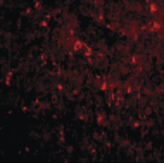 RTN4 / Nogo Antibody - Immunofluorescence of NogoA in Mouse Brain cells with NogoA antibody at 20 ug/ml.