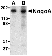 RTN4 / Nogo Antibody - Western blot of NogoA in mouse brain tissue lysate with NogoA antibody at (A) 0.5 and (B) 1 ug/ml.