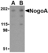 RTN4 / Nogo Antibody - Western blot of NogoA in human brain tissue lysate with NogoA antibody at (A) 0.5 and (B) 1 ug/ml.