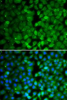 RUNX3 Antibody - Immunofluorescence analysis of MCF7 cells.