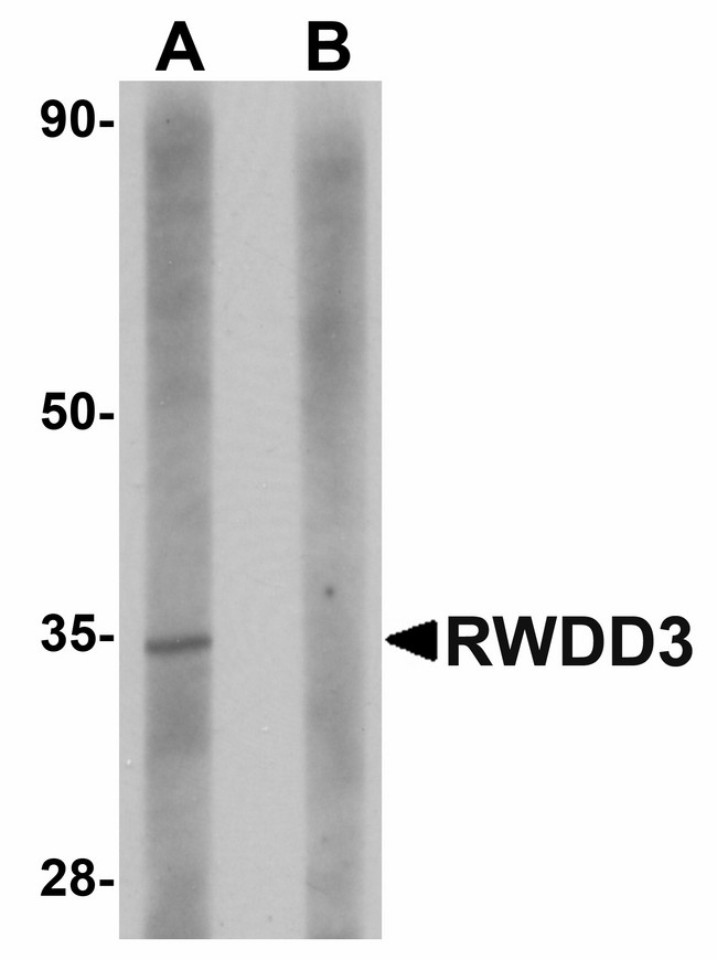RWDD3 Antibody - Western blot of RWDD3 in rat kidney tissue lysate with RWDD3 antibody at 1 ug/ml in (A) the absence and (B) the presence of blocking peptide.