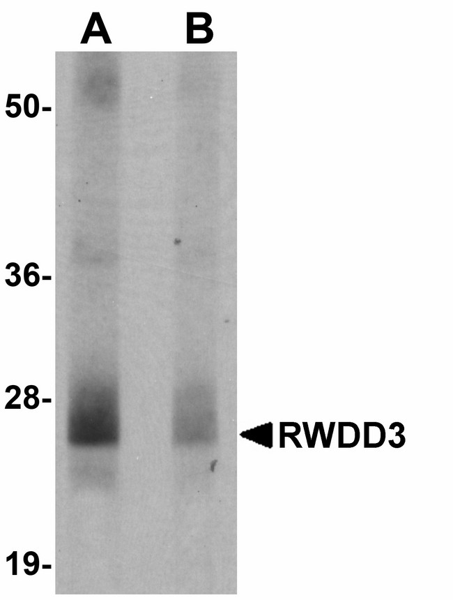 RWDD3 Antibody - Western blot of RWDD3 in mouse kidney tissue lysate with RWDD3 antibody at 0.5 ug/ml in (A) the absence and (B) the presence of blocking peptide.
