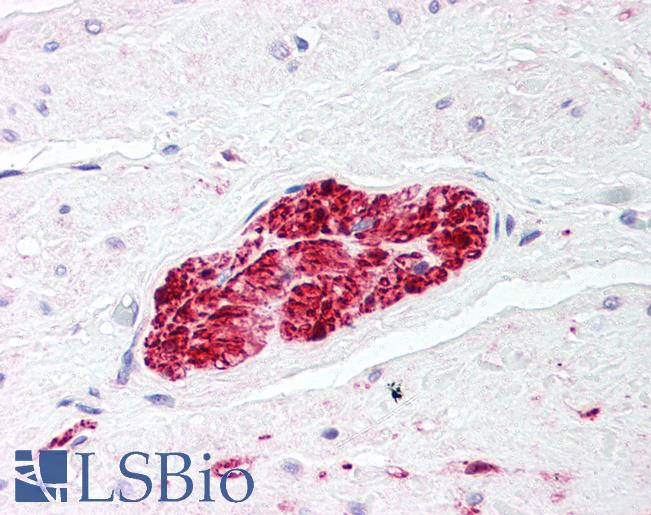 S100 Protein Antibody - Anti-S100 Protein antibody IHC of human prostate, nerve. Immunohistochemistry of formalin-fixed, paraffin-embedded tissue after heat-induced antigen retrieval. Antibody concentration 5 ug/ml.