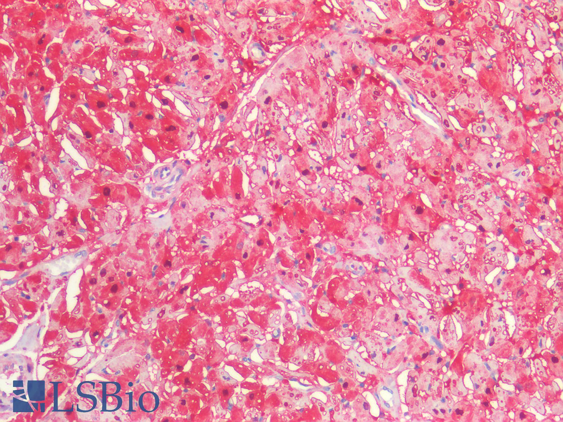 S100A1 / S100-A1 Antibody - Human Heart: Formalin-Fixed, Paraffin-Embedded (FFPE)