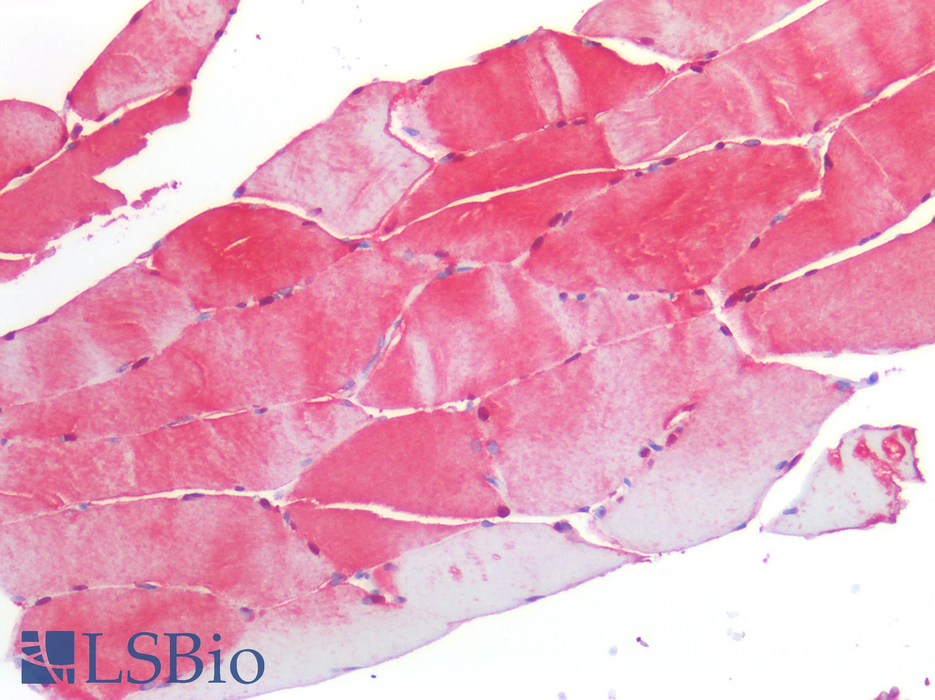 S100A1 / S100-A1 Antibody - Human Skeletal Muscle: Formalin-Fixed, Paraffin-Embedded (FFPE)