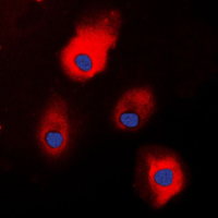S100A1 / S100-A1 Antibody - Immunofluorescent analysis of S100-A1 staining in HEK293T cells. Formalin-fixed cells were permeabilized with 0.1% Triton X-100 in TBS for 5-10 minutes and blocked with 3% BSA-PBS for 30 minutes at room temperature. Cells were probed with the primary antibody in 3% BSA-PBS and incubated overnight at 4 C in a humidified chamber. Cells were washed with PBST and incubated with a DyLight 594-conjugated secondary antibody (red) in PBS at room temperature in the dark. DAPI was used to stain the cell nuclei (blue).