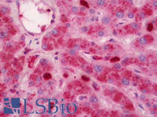 S100A10 Antibody - Human Liver: Formalin-Fixed, Paraffin-Embedded (FFPE)