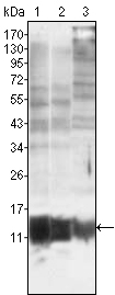 S100A10 Antibody - Western blot using S100A10/P11 mouse monoclonal antibody against MCF-7 (1), HepG2 (2) and HeLa (3).