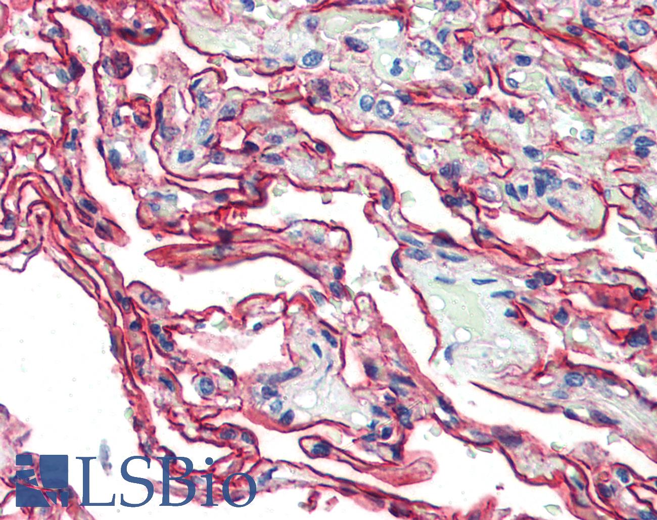 S100A10 Antibody - Anti-S100A10 antibody IHC of human lung. Immunohistochemistry of formalin-fixed, paraffin-embedded tissue after heat-induced antigen retrieval. Antibody dilution 1:200.