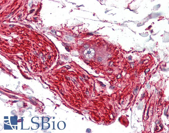 S100A10 Antibody - Anti-S100A10 antibody IHC of human nerve and ganglion cell. Immunohistochemistry of formalin-fixed, paraffin-embedded tissue after heat-induced antigen retrieval. Antibody dilution 1:200.