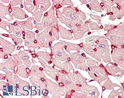 S100A10 Antibody - Human Heart: Formalin-Fixed, Paraffin-Embedded (FFPE)