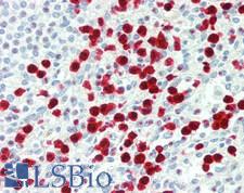 S100A12 Antibody - Human Spleen: Formalin-Fixed, Paraffin-Embedded (FFPE), at a concentration of 10 ug/ml. 