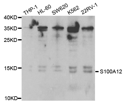 S100A12 Antibody - Western blot analysis of extracts of various cell lines.