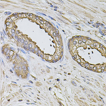 S100A12 Antibody - Immunohistochemistry of paraffin-embedded human prostate tissue.