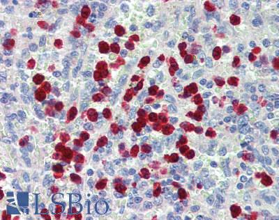 S100A12 Antibody - Human Spleen: Formalin-Fixed, Paraffin-Embedded (FFPE)