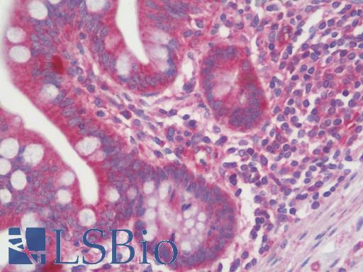 S100A16 Antibody - Anti-S100A16 antibody IHC staining of human small intestine. Immunohistochemistry of formalin-fixed, paraffin-embedded tissue after heat-induced antigen retrieval. Antibody dilution 1:200.