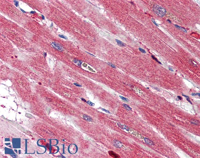 S100A4 / FSP1 Antibody - Anti-S100A4 antibody IHC of human heart. Immunohistochemistry of formalin-fixed, paraffin-embedded tissue after heat-induced antigen retrieval. Antibody concentration 5 ug/ml.