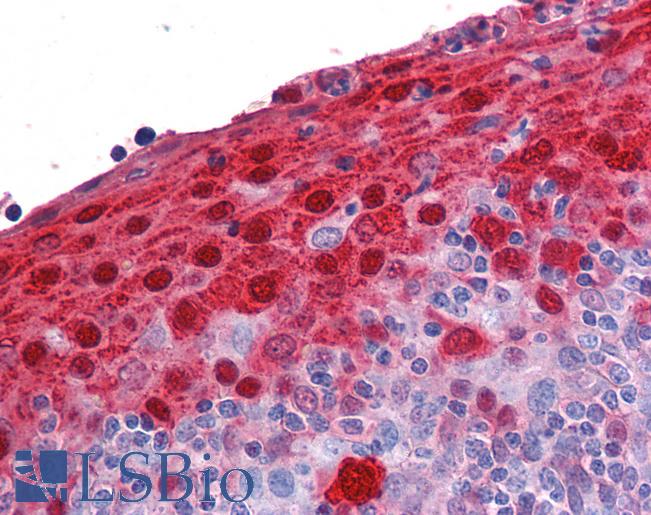 S100A7 / Psoriasin Antibody - Anti-S100A7 antibody IHC of human tonsil. Immunohistochemistry of formalin-fixed, paraffin-embedded tissue after heat-induced antigen retrieval. Antibody concentration 3.75 ug/ml.