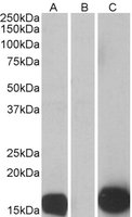S100A7 / Psoriasin Antibody - HEK293 lysate (10 ug protein in RIPA buffer) overexpressing Human S100A7 with C-terminal MYC tag probed with S100A7 antibody (0.5 ug/ml) in Lane A and probed with anti-MYC Tag in Lane C. Mock-transfected HEK293 probed with S100A7 antibody (1 mg/ml) in Lane B. Primary incubations were for 1 hour. Detected by chemiluminescence.