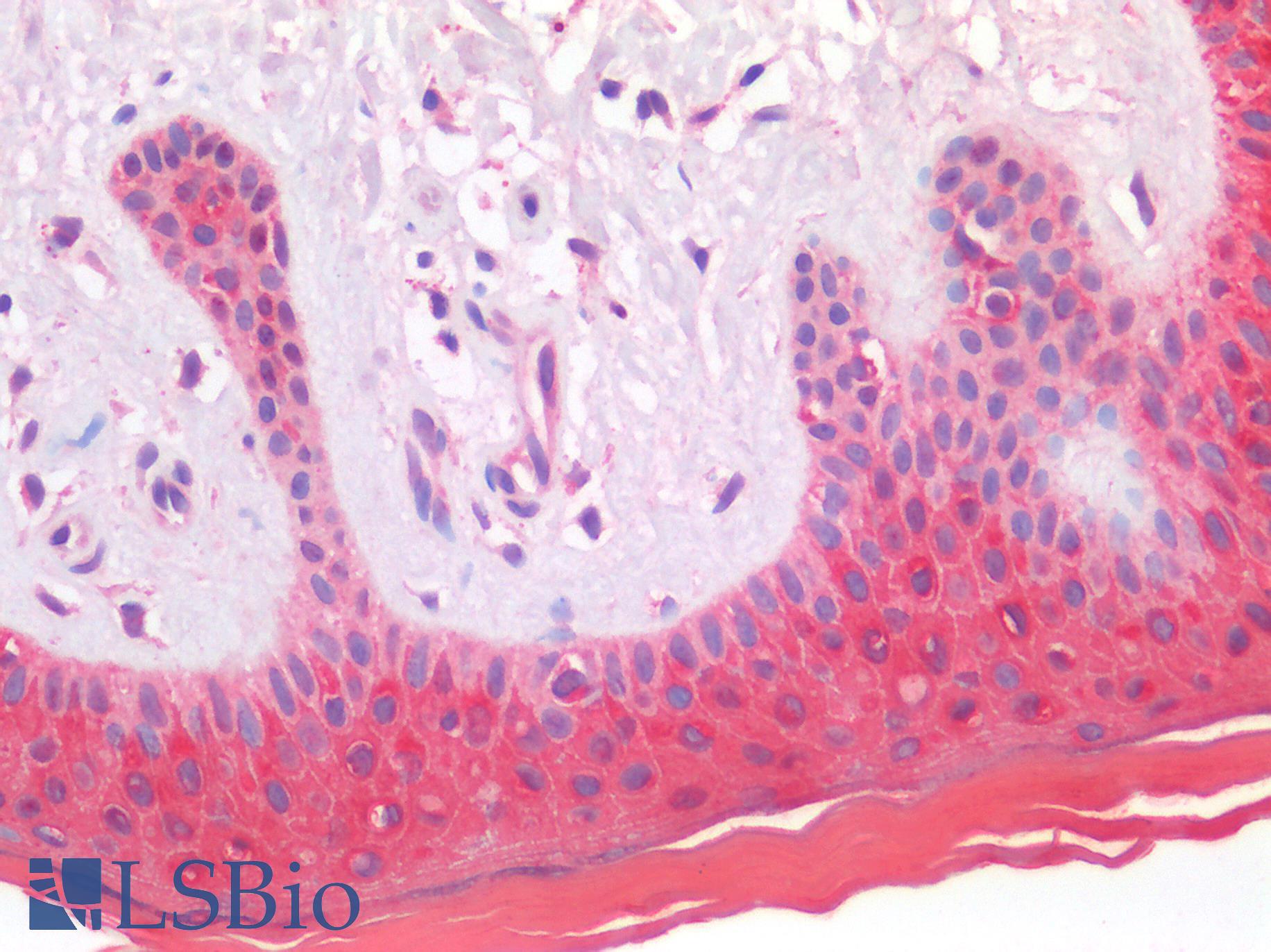 S100A8 / MRP8 Antibody - Human Skin: Formalin-Fixed, Paraffin-Embedded (FFPE)